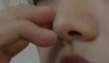 陕西西安：17岁少女流了十年脓鼻涕，只因鼻子里长“石头”