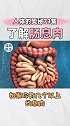 肠息肉是怎么肥四，一起来了解 息肉 肠道健康 科普