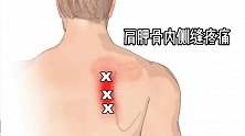 后背肩胛骨缝痛是怎么回事？学会这个拉伸方法，快速止痛不反复