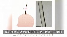 年纪轻轻就长白发？一截黑、一截白？或是身体在警告