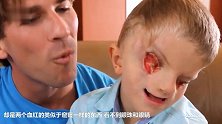 10岁男孩因患怪疾 脸部畸形扭曲 还没有眼睛！