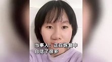 01年女生鼻子上长大“洞”，又在额头上养出个“新鼻子”：长期往里灌生理盐水