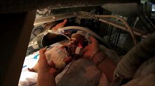 护士悉心照料31周早产儿，宝宝细胳膊细腿让人不得不小心翼翼