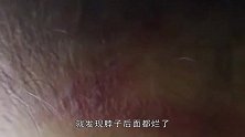 为迎新年女子去“剪发”，不料半夜头晕目眩，一照镜子竟被吓懵了