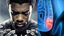 漫威“黑豹”患结肠癌去世，“闻”屁可以早期发现？