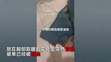 女子开艾灸垫取暖越睡越热，起床一看吓坏-冒烟床垫被烧漆黑