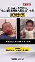 “戒之馆婴亲霜致大脸娃娃”？尽快调查回应疑点   大头娃娃