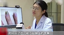 女子做完美甲后指甲长霉菌，有人甚至因美甲感染HPV病毒，部分美甲店卫生堪忧
