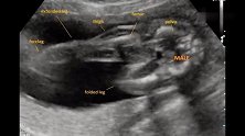 妊娠B超，宝宝内脏已发育成型，视频里是个男孩！