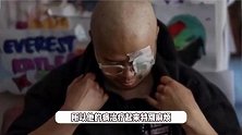 好莱坞知名演员因癌症离世，年仅42岁留下5岁女儿，因抗癌还失去一只眼睛