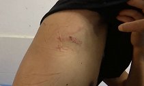 贵州贵阳：寒心！保安与人发生冲突，结果反被上司打进医院