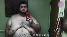 励志27岁小哥成功减282斤，切除的松弛皮肤有近12斤