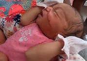 美国：一女婴出生时被医生用手术刀割伤脸颊，需要缝13针