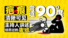 身上的疤痕清晰可见 主持人讲述亲历过的事故 | 弯道90度