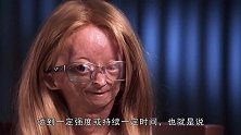 孩子患上了早衰症，是正常人衰老速度的十倍，真相令人落泪