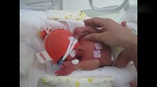 感动！保温箱里的早产宝宝第一次握住爸爸的手