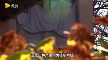 这样过敏都行？美国女子对大多数东西甚至对自己的丈夫也过敏！