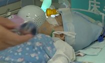 祝贺！66天婴儿换心手术成功 重获新生