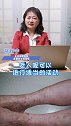 皮炎 医学科普 抖来学习   如何治疗老年人淤积性皮炎