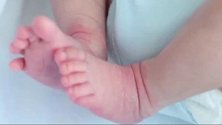 婴幼儿切勿过度防晒！5个月婴儿被家长涂防晒霜后起满红斑