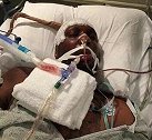篮球-15年-曝奥多姆病再度恶化 脑部受损不识家人密友-新闻
