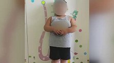 浙江杭州：5岁男孩76斤！腰围跟成人一样粗 已有脂肪肝倾向