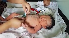 刚出生的小宝宝，护士给小宝宝穿衣服，小宝宝好可爱！