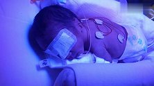 28周早产儿照蓝光，乖乖趴着不敢动，让人看得好心疼