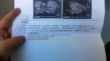 一查就是癌症晚期？6大高发癌的预警信号和筛查方法，赶紧收藏