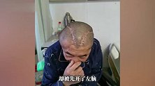 包头一男子右脑出血被开左脑，医生发现出错又开右脑