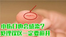 小伤口也会感染？3大处理误区一定要避开，不然等吃亏就晚了