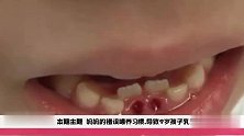 育儿：妈妈的错误喂养习惯，导致9岁孩子乳牙滞留长出双排牙