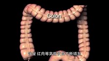 大肠癌离你有多远？预防，要做好这几件事！