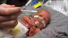 32周早产儿躺在保温箱中像个小老头，看着好可爱
