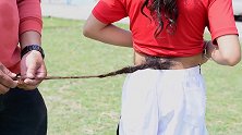 尼泊尔16岁男孩拥有70厘米长“尾巴” 在社交媒体上走红