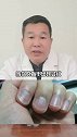 指甲上总是出现竖条纹，到底是什么情况呢？听听范教授怎么说 #中医养生  #健康