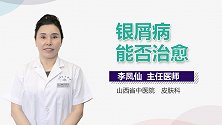 银屑病能否治愈？