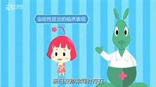 被蚊虫叮咬后：为何有人起包，有人却没事？