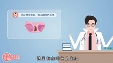 怀孕后，分泌物为什么会增多？