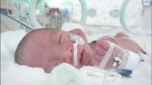 早产儿在保温箱的第3天，睡觉总是半睁眼，还会翻白眼，惹人心疼