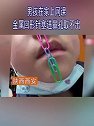 陕西西安：男孩家中上网课 金属回形针塞进鼻孔取不出