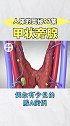 甲状腺甲状旁腺这个戏精：4个旁腺一台戏！ 科普  健康  暑期知识大作战