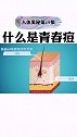 科普青春痘是怎么生长的？健康 涨知识