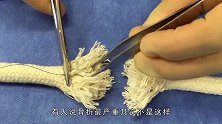 病人断掉的筋是怎么接起来的？看看模拟操作过程，看着都疼！