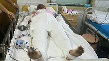 皮肤被烧焦滴油、警服烧成碎片…他强忍烈火灼身的剧痛救人！