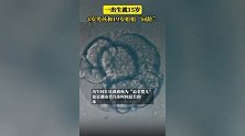 湖南一婴儿刚出生就“15岁”，咋回事？