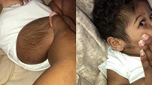 美国：一3个月大女婴毛发浓密，浑身长出黑色汗毛