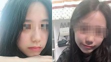 被裸照威胁轻生女孩捐献器官救5人：2人已重获光明