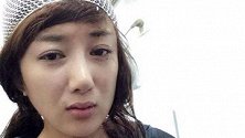 李依晓被叶璇的狗咬毁容，整容5次判若两人，网友：变漂亮了