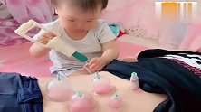 搞笑剧：宝宝帮暖爸拔火罐，这下玩的不亦乐乎了，动作还有模有样